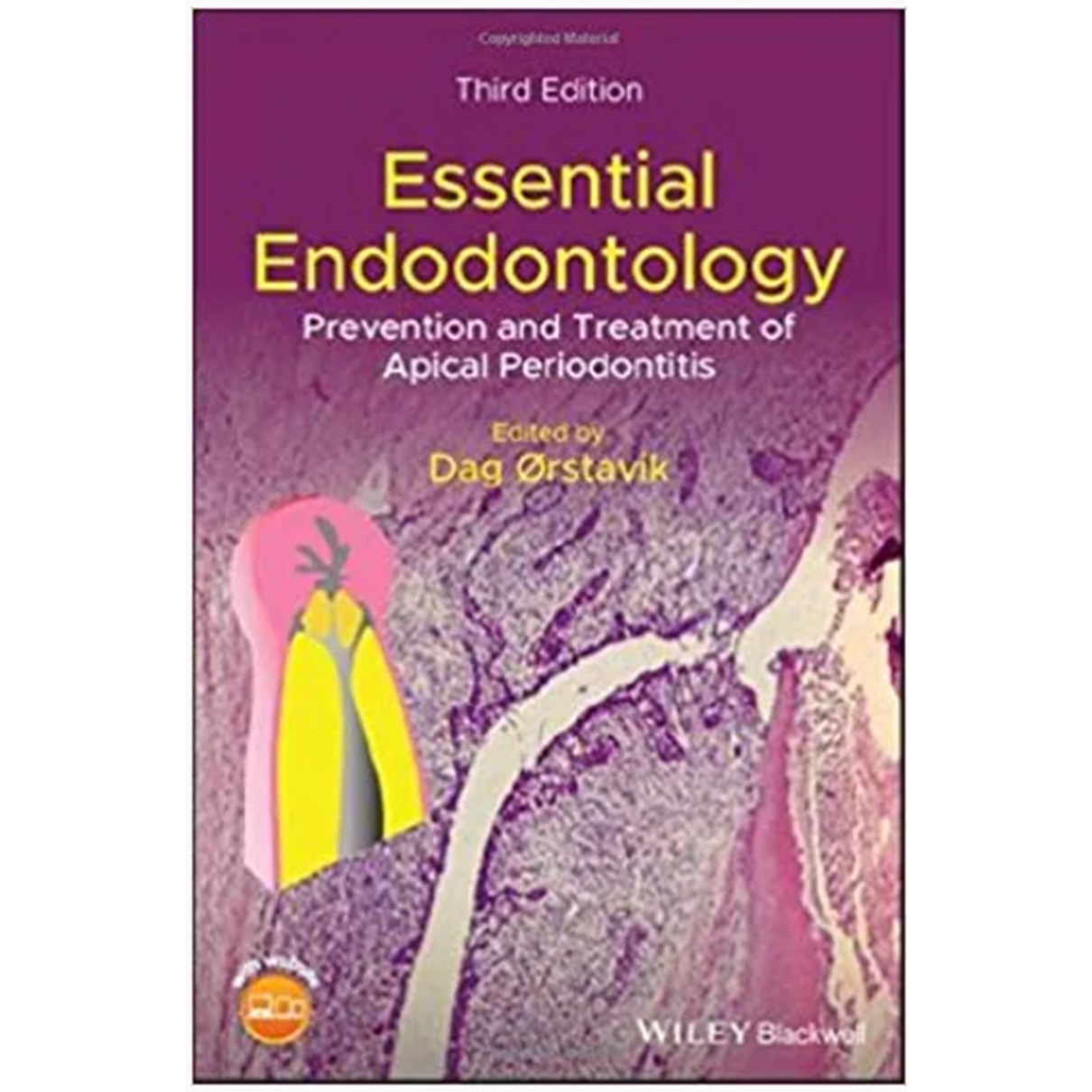 Essential Endodontology: Prevention and Treatment of Apical Periodontitis